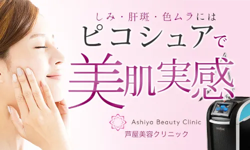 最新機器「ピコシュア」で美肌実感、お肌のシミを解消
